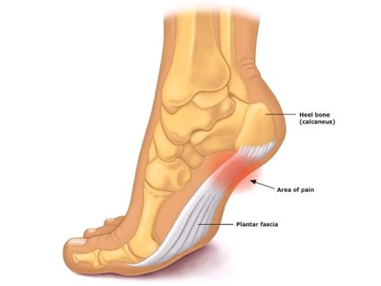 Common Foot Problems for Runners