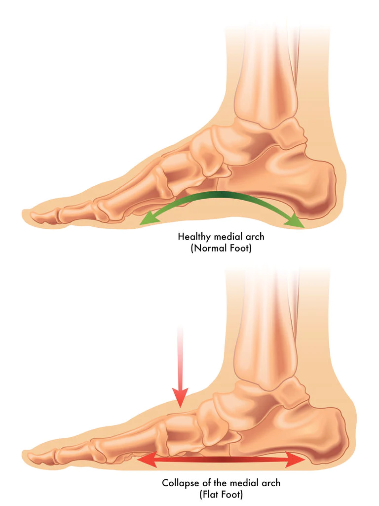 How Does the Foot Work While Running